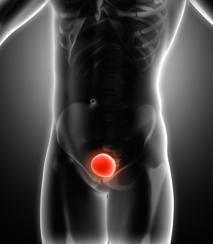 3D medical image showing bladder